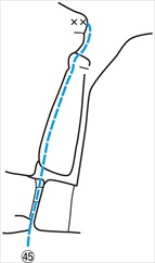 1-045-3-ISHIGAKI-YAMA