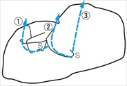 4-099-5-FUKUBE