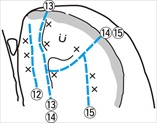 3-010-1-BOKODAKI-IWA